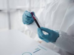 Epatite A in forte crescita in Italia: Lazio, Campania e Puglia le regioni con più casi