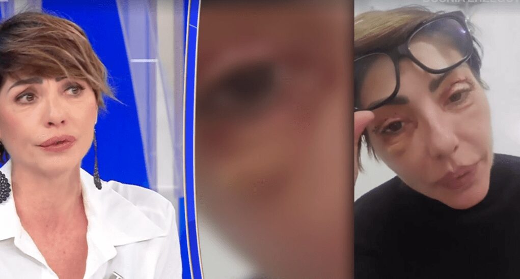 Ilaria Galassi, insulti social per i ritocchi estetici: “Offese anche sui miei figli”