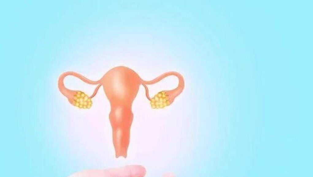 In Italia 15 nuove diagnosi al giorno di cancro all’ovaio, al via campagna ‘Insieme di Insiemi’