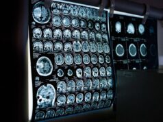 Uno spray nasale ferma l’invecchiamento del cervello, lo studio