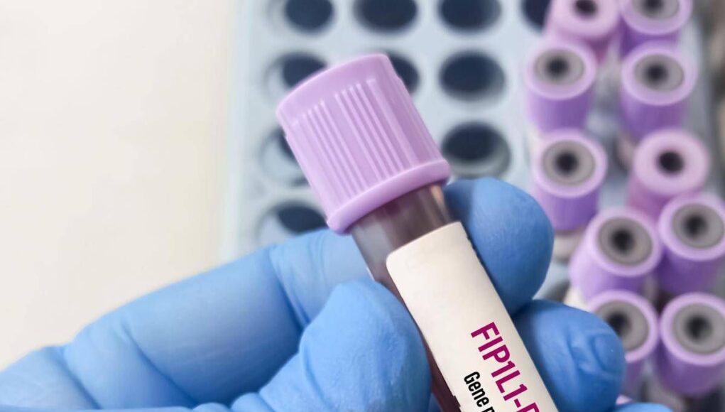 Giornata patologie eosinofile, allergologo Caminati: “Diagnosi complessa”