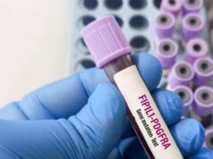 Giornata patologie eosinofile, allergologo Caminati: “Diagnosi complessa”