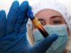 Hantavirus, negativo il turista inglese in quarantena a Milano. Test per una donna ricoverata a Messina