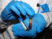 Hantavirus, test negativo per la persona in isolamento in Veneto