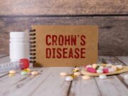 Malattia Crohn con fistole, nuovi dati su terapia monoclonale