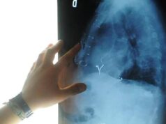 Radiologia interventistica, Ssn e fondazioni per cure più accessibili