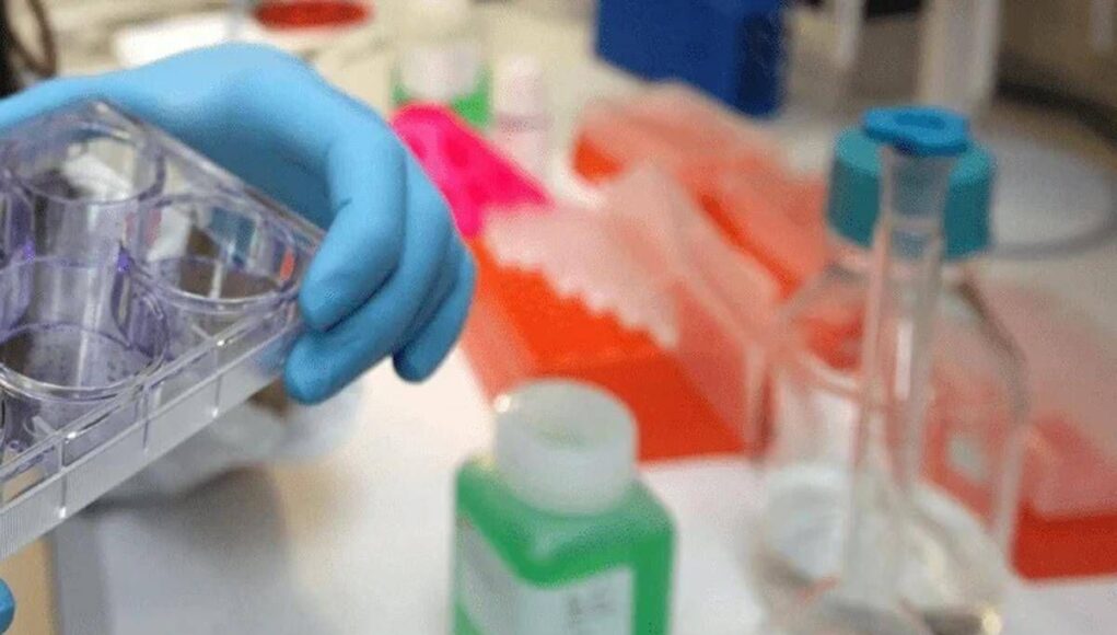Cancro alla vescica, Berardi (Aiom): “Sangue nelle urine segnale da non sottovalutare”