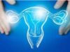 Cancro endometrio avanzato, nuove terapie migliorano sopravvivenza